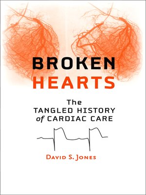 Broken Hearts - ebook